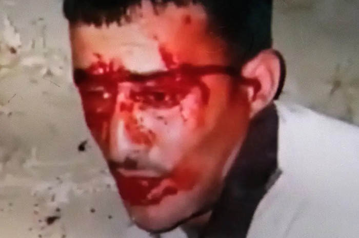 Le visage de Majdi Ikhtat, dans une vidéo prise par ses assaillants – Image via Haaretz