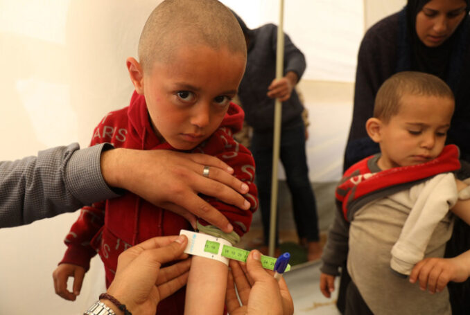 Photo : Eyad El Baba Mohammad / UNICEF